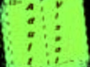 Summertime saga 174 nastavlja priču