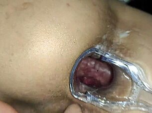 Anal Masturbation Using Dilator And Medical Speculum