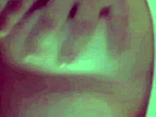 Second Part of the Video Call