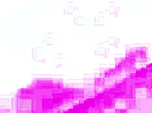 Nympho Kyra Sex Takes Baseball Bat Up Ass.