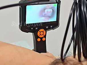 Viet Nam Nội Soi Khám Phá Bên Trong Bím Xinh Ẩm Ứt