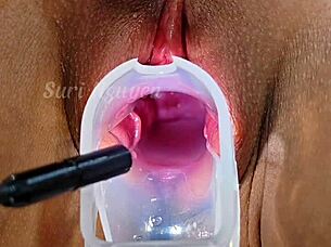 Viet Nam Nội Soi Khám Phá Bên Trong Bím Xinh Ẩm Ứt