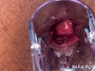 anal vision speculum on a big hairy bbw slut