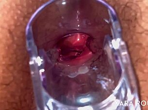 anal vision speculum on a big hairy bbw slut