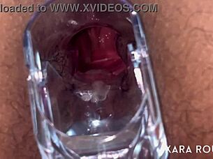 anal vision speculum on a big hairy bbw slut