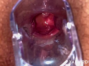 anal vision speculum on a big hairy bbw slut