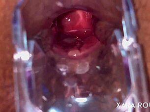 anal vision speculum on a big hairy bbw slut