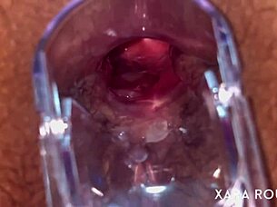 anal vision speculum on a big hairy bbw slut