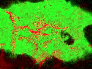 i got seduced by that lesbian docter in the hospital.