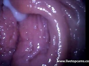 Girl Cums Filmed From Inside A Vagina At Secretfriends Com