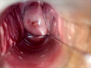 Intense Vaginal Close-Up Leads To Explosive Orgasm