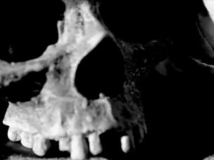 zombies retreat ep 2 walkthrough