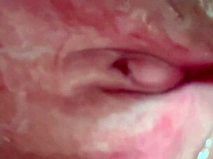 Amateur's Update 106 Days After First Time