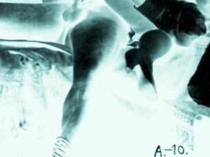 Vintage Erotic Art Featuring Antique Seductive Poses