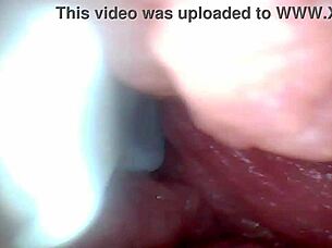 Endoscope camera explores penis's sensitive parts for education
