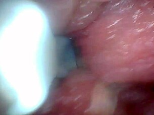 Endoscope camera explores penis's sensitive parts for education