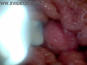 Endoscope camera explores penis's sensitive parts for education