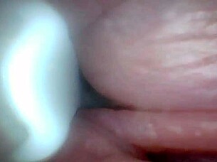 Endoscope camera explores penis's sensitive parts for education
