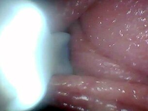 Endoscope camera explores penis's sensitive parts for education