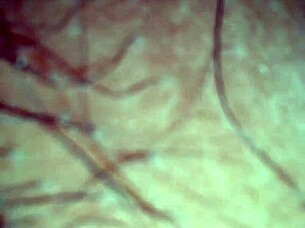 Myra's sex scandal exposed in public