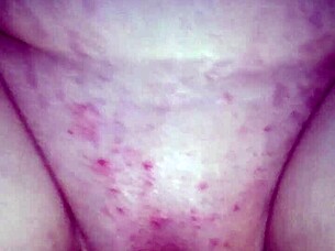 사던스트로크스 트윙크 잭 토드 보리스 오를라 맨박 림잡 핫 액션