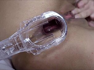 fisted my ass after speculum play, leaving it gaping wide