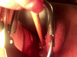 cervix stretching and insertion feels intense