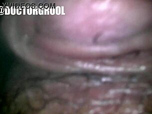 Endoskop Dokter Jelajahi Memek Basah Krim Dalam Video Pemeriksaan Panas